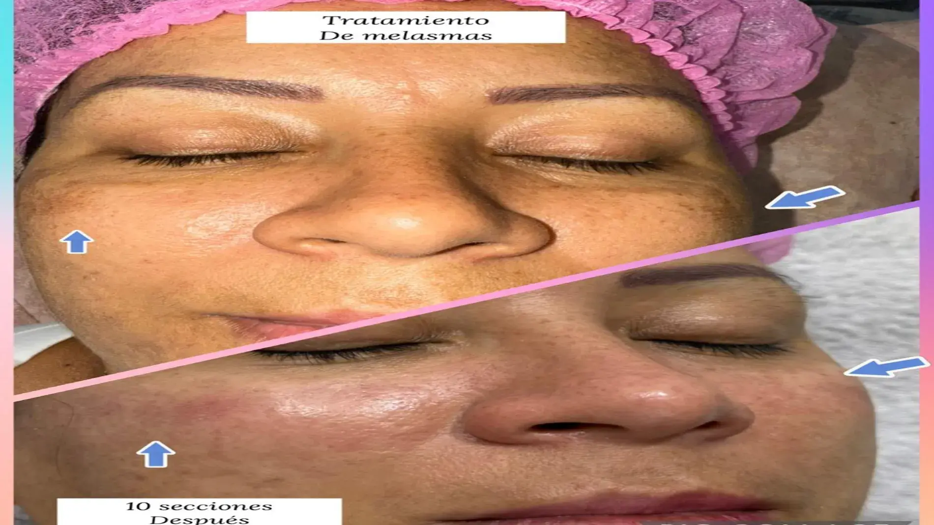 geraldinne aron centro d ebelleza ibague